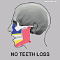 当一个人失去了全部牙齿，会发生什么！涨姿势了！