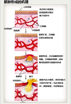 Yeagle采集到医学