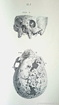 在当地古董店买的东东。。20世纪美妙的 Osteographia 副本，插图简直精致！这书超级巨大！ | 来自 Emma Dixon #论文医学插画欣赏# #怎样成为医学插画师# #科学插画# #医学插画# 科普 #医学美图# ​​​​