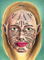 Chinese face map. According to Chinese medicine, where you break out has a lot to do with what is going on internally. For example, acne on cheeks is typically more lifestyle/emotionally related, where as chin breakouts can be hormonally based....really, 