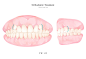 牙龈牙齿 虎牙矫正 口腔美容 健齿插图插画设计PSD tid273t000501