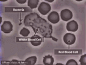 体内的白细胞追杀细菌