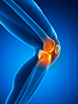 科学,健康保健,计算机制图,四肢,腿_513088737_Human knee pain, artwork_创意图片_Getty Images China
