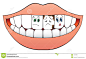 Image result for missing teeth clipart