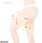 腿部提拉 消脂运动 局部瘦身 吸脂整形插图插画设计PSD tid273t000517医疗保健素材下载-优图网-UPPSD