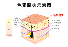 抠脚皮的仙女采集到疤痕