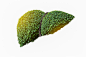 逼真的肝脏图像是人类绿树形状的疾病和肝硬化(环境)。