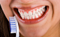 TEETH WHITENING IN MONTGOMERY by dentistryatparkplace on 500px