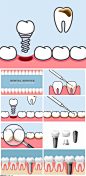 8款牙齿牙科拔牙牙医补牙插画AI素材2020108 - 设计素材 - 比图素材网
