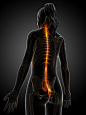 女性骨骼脊椎神经