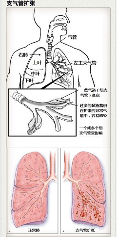 Yeagle采集到医学