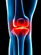 科学,健康保健,计算机制图,四肢,腿_513091469_Human knee pain, artwork_创意图片_Getty Images China