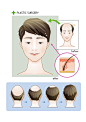 男士植发歇顶植发过程毛囊帅哥医美整形插画男士|植发|歇顶|过程|帅哥|整形|插画