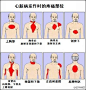 当出现以下部位疼痛时，需警惕心脏病发作