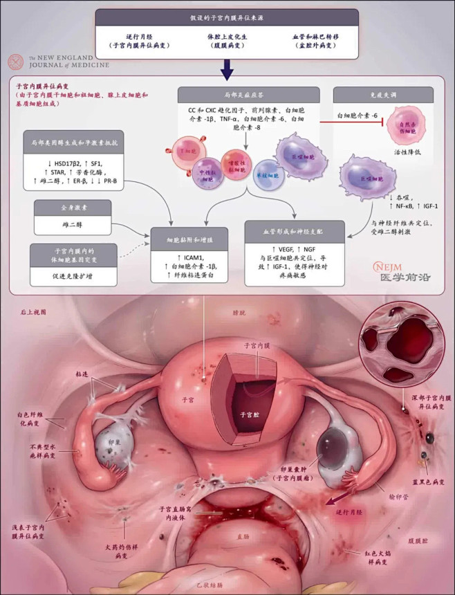 《新英格兰医学杂志》图解：影响近两亿女性...