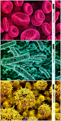 给力创意广告超细圆珠笔的创意广告，显微镜下的美丽，在细菌上涂鸦！