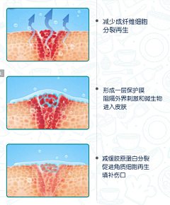 抠脚皮的仙女采集到疤痕