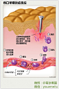 临床笔记 l 伤口早期炎症反应