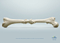 Forteo | McCann Health | Stronger Bones | WE LOVE AD