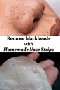 The most popular solution used by anyone to remove blackheads is a nose strip. You can find them in any drug store or supermarket. But what do you do when you urgently need one and you have none in your home. Simple… you make your own nose strip and remov