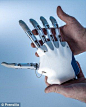 First bionic hand that allows patients to 'feel' sensations