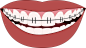 牙齿矫正, 微笑, 牙齿, 牙医, 牙科, 口, 装置, 图标, 图