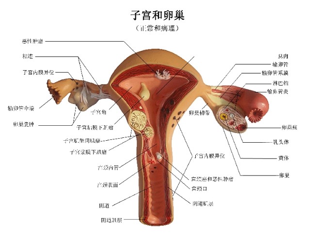 ENOVO颐诺人体女性子宫卵巢阴道疾病模...