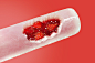 Ice cream with strawberry jam : Retouching image for package