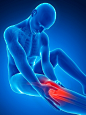 科学,健康保健,计算机制图,四肢,腿_513088727_Human knee pain, artwork_创意图片_Getty Images China