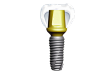 dental implant