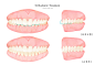 牙齿美容 咬合线 美丽牙齿 健齿插图插画设计PSD tid273t000502