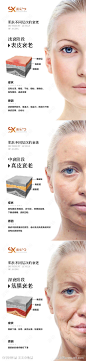 面部肌肤不同层次的衰老-源文件-志设网-zs9.com