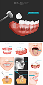 10款牙齿牙科拔牙补牙牙套种牙插画-2PSD素材2020413 - 设计素材 - 比图素材网