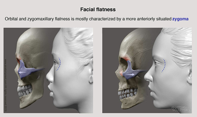 Facial Flatness