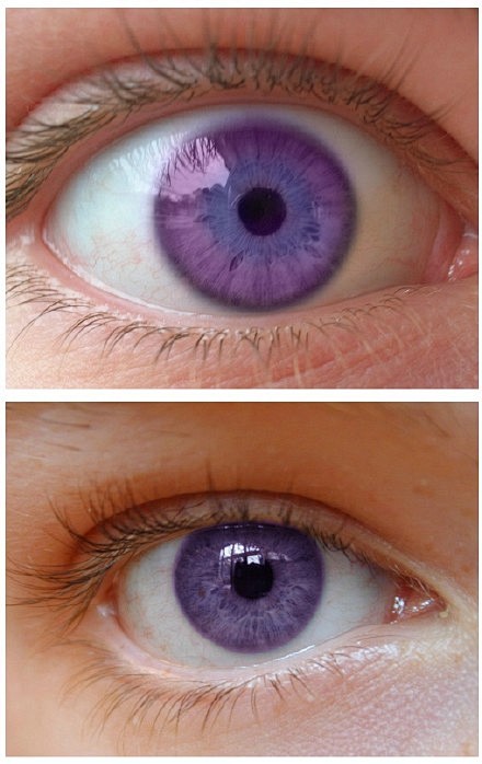 世界上只有600多人拥有的天然紫色瞳孔！...