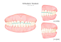 定位复位 牙齿美容 矫正定位 健齿插图插画设计PSD tid273t000503