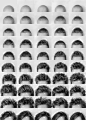 A woman with cancer took photos of her hair coming back after chemo.
