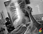 震撼：摄影师记录印度艾滋病人生活第2页