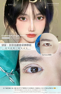 娜DADA采集到案例对比