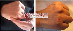 液门穴的准确位置图