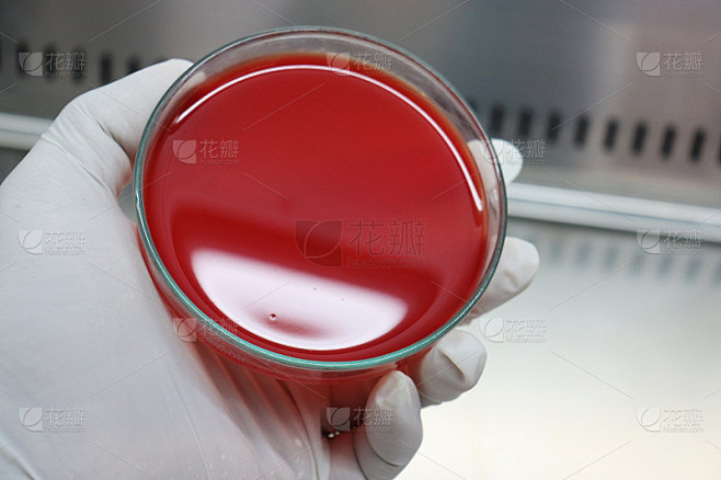 血琼脂(Blood Agar, BA)是用于培养不易生长的细菌或微生物的富集培养基。