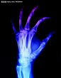 X光 手骨 医疗 科技卫生