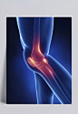 膝盖关节骨骼CT|膝盖,关节,骨骼,CT,其他,漂浮元素