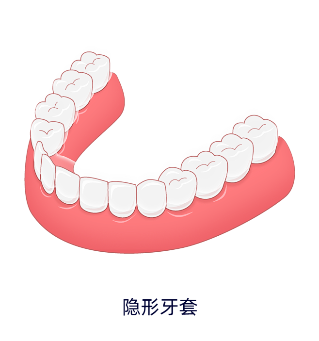 牙套正畸牙齿矫正材料种类-隐形牙套