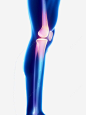关节模型png免抠素材_新图网 https://ixintu.com 关节 疼痛 膝盖 人物模型 关节膝盖疼痛