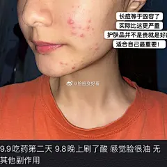 集