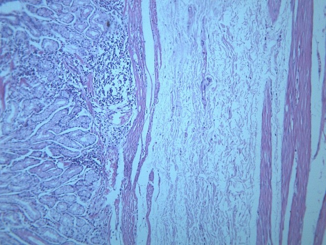 慢性萎缩性胃炎显微切片图片