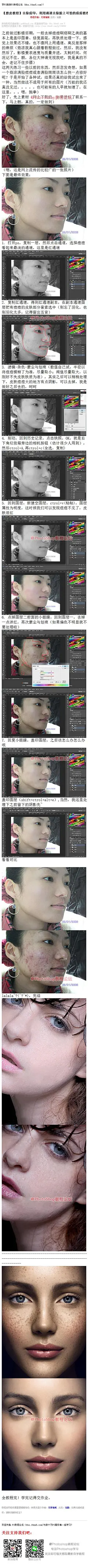 《利用通道去除脸上可怕的痘痘教程》 影楼去痘印基本上是盖印图章、修复画笔，再肤质处理一下，感觉上效果还不错，也不像网上用通道、高反差那样的麻烦，今天跟大家分享一篇用通道去痘印的#教程# #www.16xx8.com##ps##photoshop##教程##ps教程##I去除痘印I#：http://www.16xx8.com/plus/view.php?aid=138082&amp;pageno=all