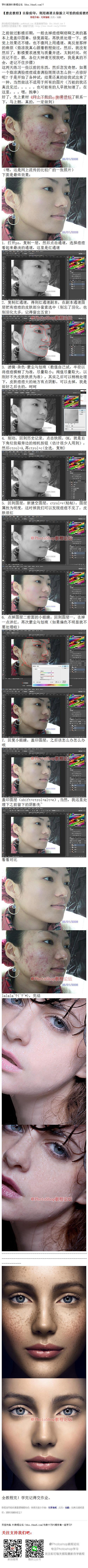 《利用通道去除脸上可怕的痘痘教程》 影楼...