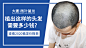 植发   活动banner   医疗美发    品牌宣传  信息流
